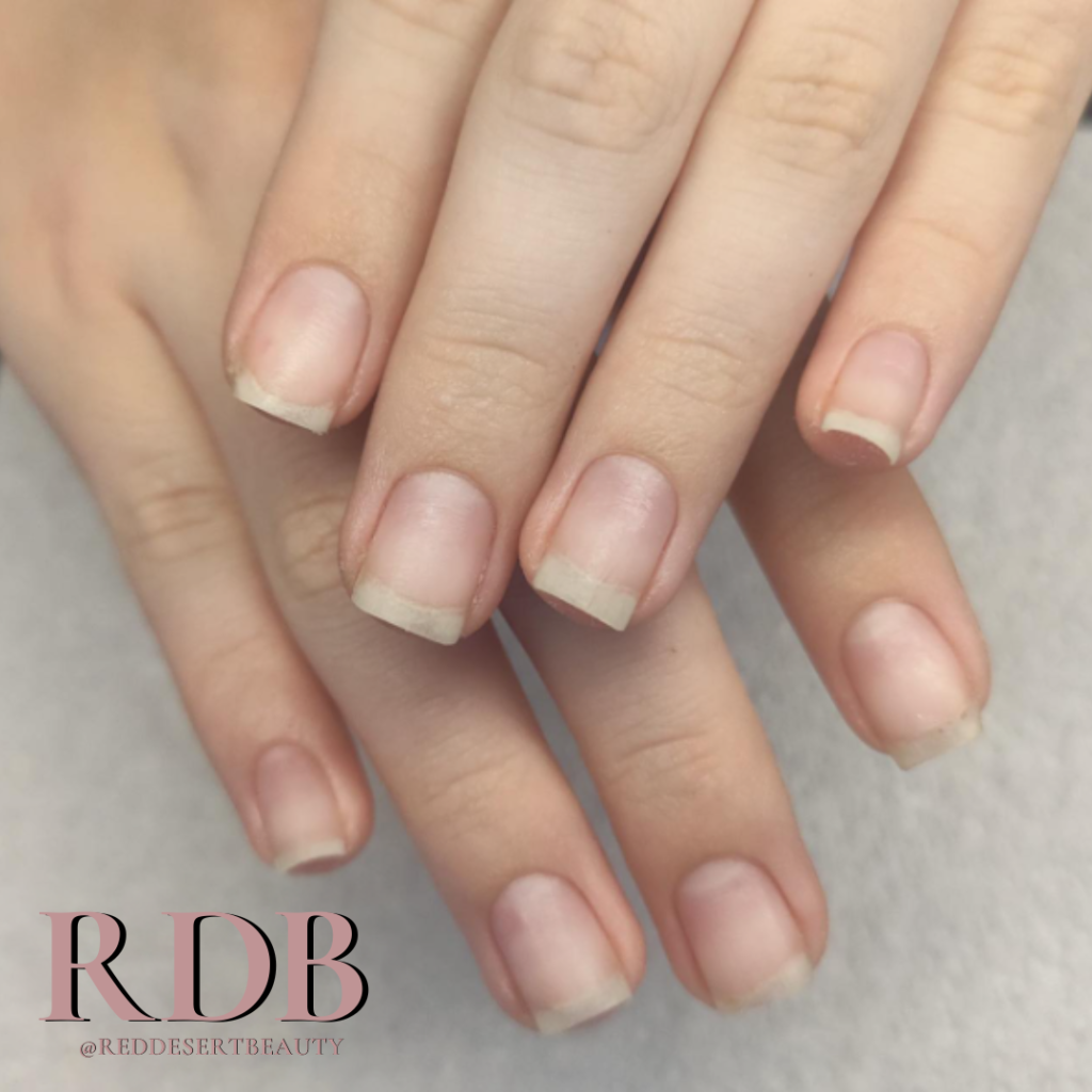 Correct removal performed by RDB